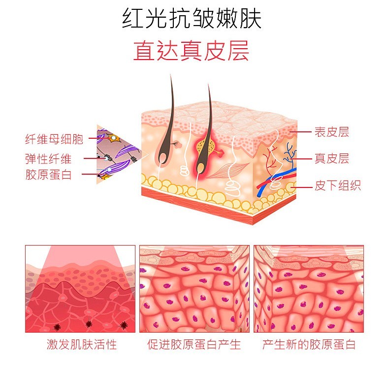 嫩肤滤光片成效 嫩肤滤光片成效
