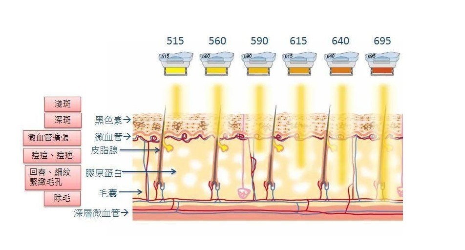 强脉冲滤光片光子美容波段渗入皮肤层