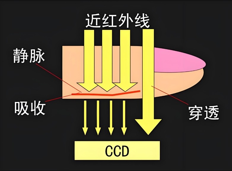 静脉显像仪道理