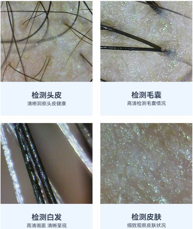 头皮检测仪的职能成效 头皮检测仪的职能成效