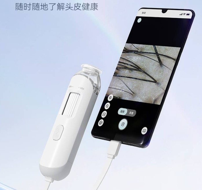 头皮检测仪链接办机查看成效 头皮检测仪链接办机查看成效